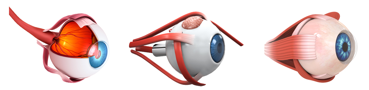Adult Eye Muscle Surgery - Saratoga Ophthalmology